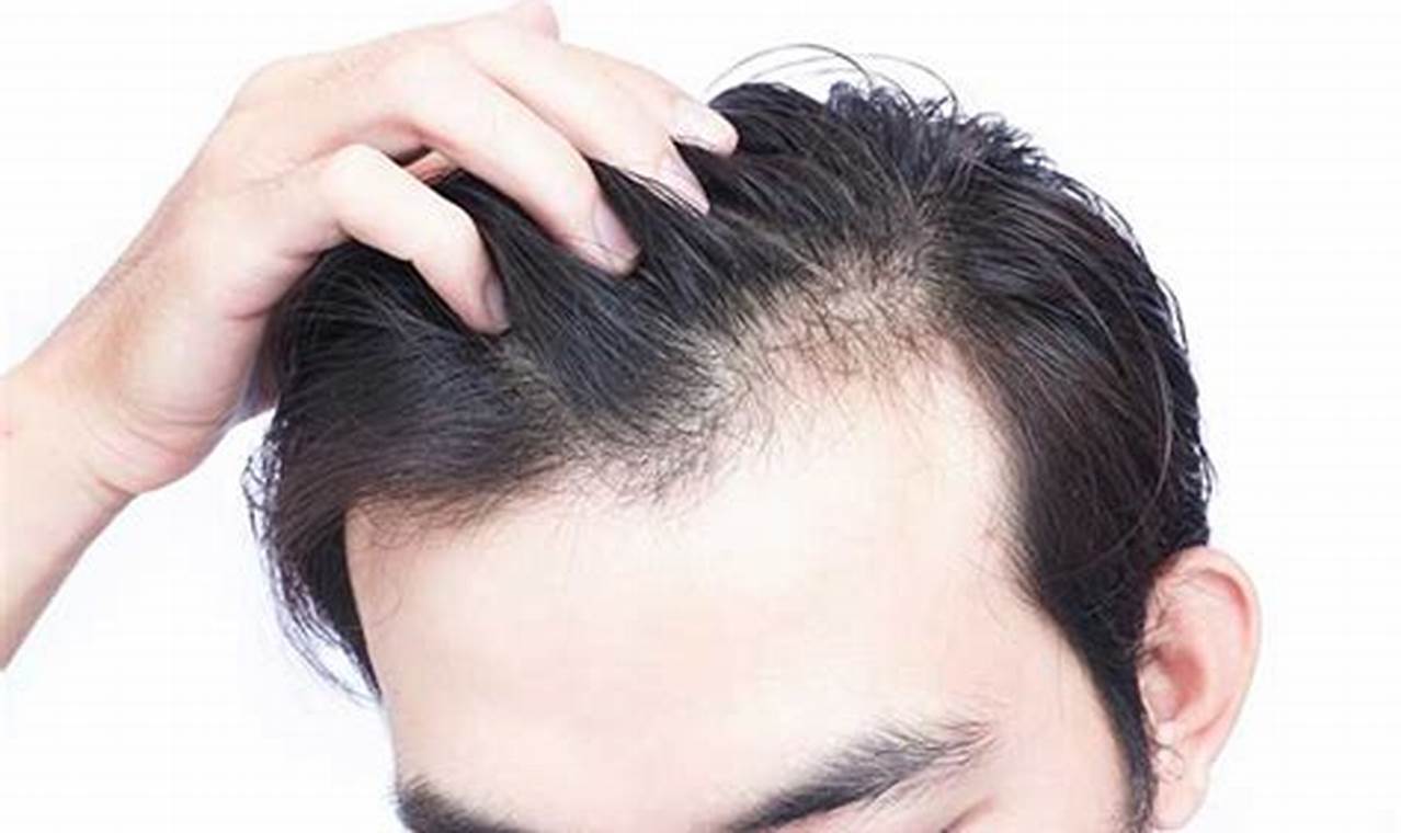 cara mengatasi rambut lepek